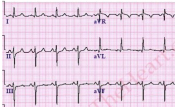f:id:tsunepi:20161127201654p:plain