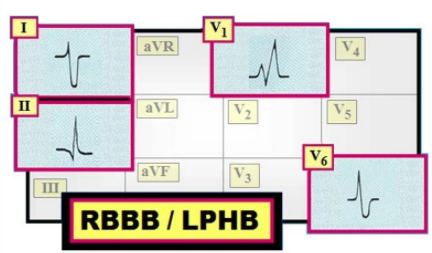 f:id:tsunepi:20161127201859p:plain