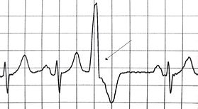 f:id:tsunepi:20161211152315p:plain f:id:tsunepi:20161211152315p:plain
