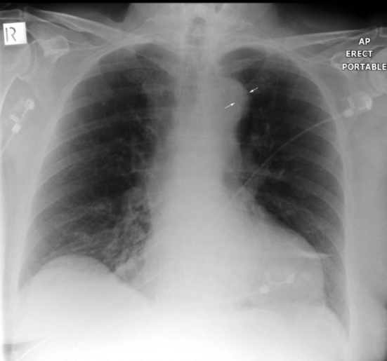 f:id:tsunepi:20161224152440p:plain