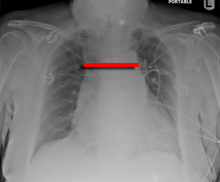 f:id:tsunepi:20161224161019p:plain f:id:tsunepi:20161224161019p:plain