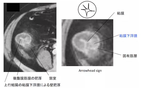 f:id:tsunepi:20161225103235p:plain f:id:tsunepi:20161225103235p:plain