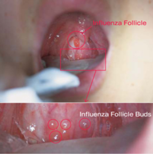 f:id:tsunepi:20170102110736p:plain