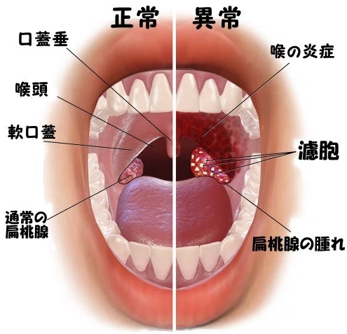f:id:tsunepi:20170102111122p:plain