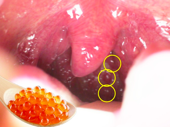 f:id:tsunepi:20170102111339p:plain