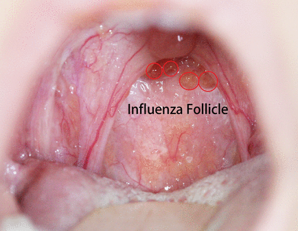 f:id:tsunepi:20170102111718p:plain