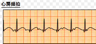 f:id:tsunepi:20170118144230p:plain