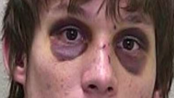 f:id:tsunepi:20170118201954p:plain