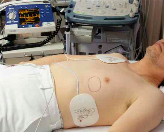 f:id:tsunepi:20170201214900p:plain