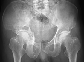 f:id:tsunepi:20170301071914p:plain