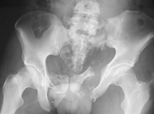 f:id:tsunepi:20170301072220p:plain