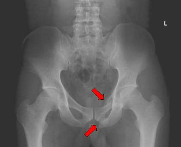 f:id:tsunepi:20170301072506p:plain