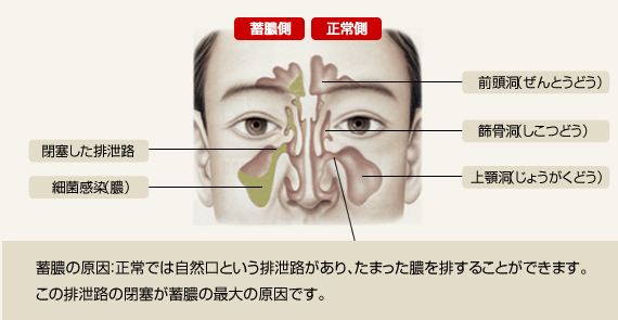 f:id:tsunepi:20170316062409p:plain