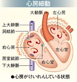 f:id:tsunepi:20170401125926p:plain