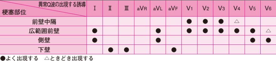 f:id:tsunepi:20170402215341p:plain f:id:tsunepi:20170402215341p:plain