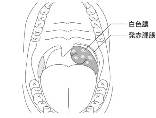 f:id:tsunepi:20170427080217p:plain