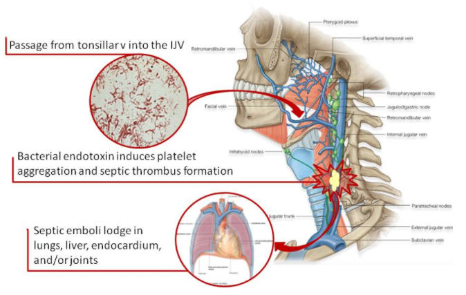 f:id:tsunepi:20170429092828p:plain