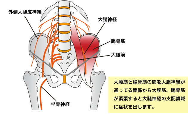 f:id:tsunepi:20170513173609p:plain