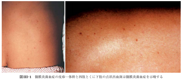 f:id:tsunepi:20170516054408p:plain f:id:tsunepi:20170516054408p:plain