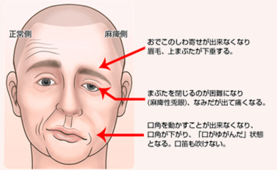 f:id:tsunepi:20170530191812p:plain