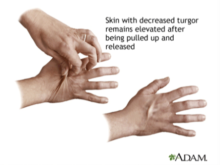 f:id:tsunepi:20170721205749p:plain f:id:tsunepi:20170721205749p:plain