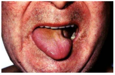 f:id:tsunepi:20170731192146p:plain f:id:tsunepi:20170731192146p:plain