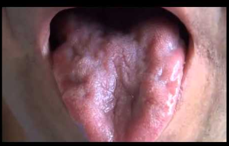 f:id:tsunepi:20170804163201p:plain f:id:tsunepi:20170804163201p:plain