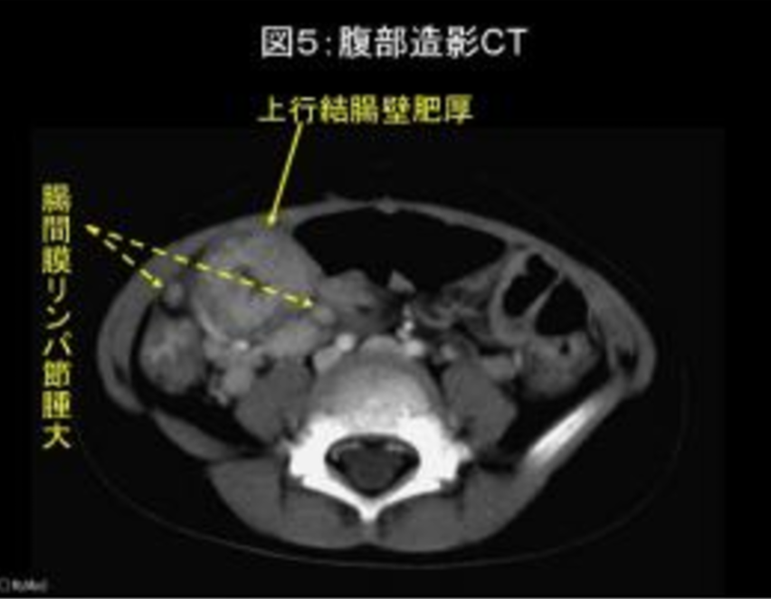 f:id:tsunepi:20171001102332p:plain
