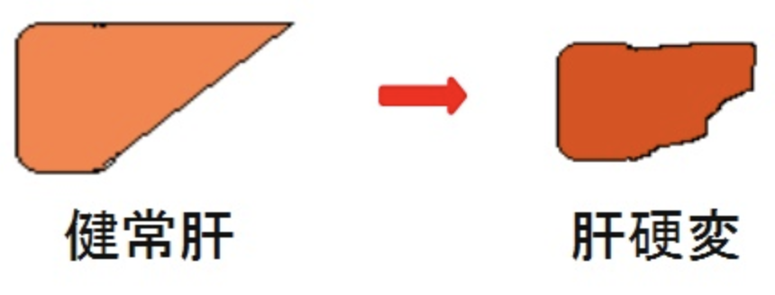 f:id:tsunepi:20171105174854p:plain f:id:tsunepi:20171105174854p:plain