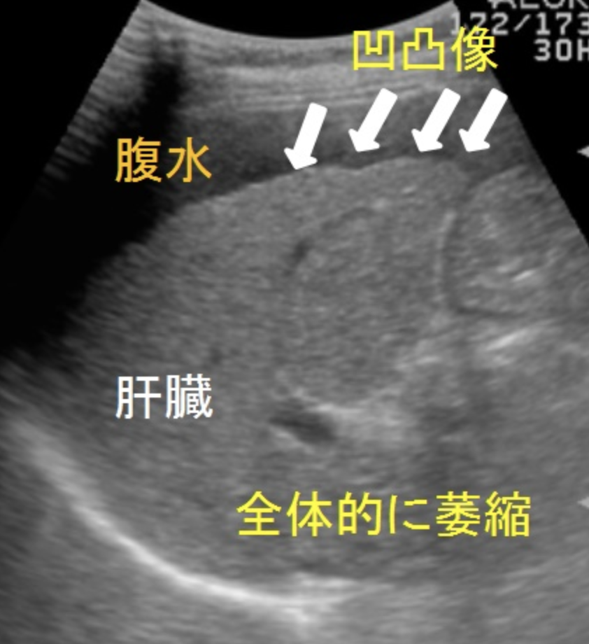 f:id:tsunepi:20171105175019p:plain f:id:tsunepi:20171105175019p:plain