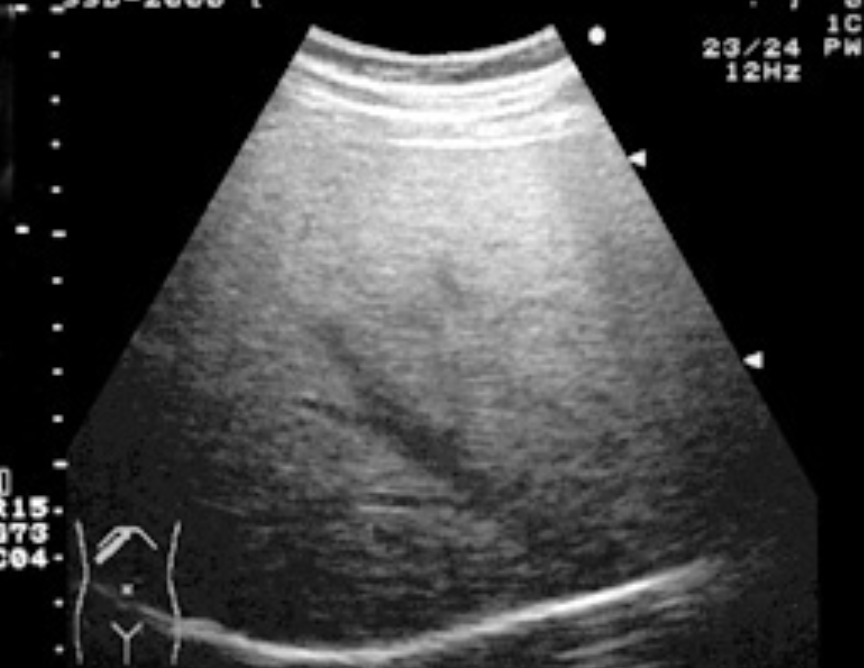 f:id:tsunepi:20171105181457p:plain f:id:tsunepi:20171105181457p:plain