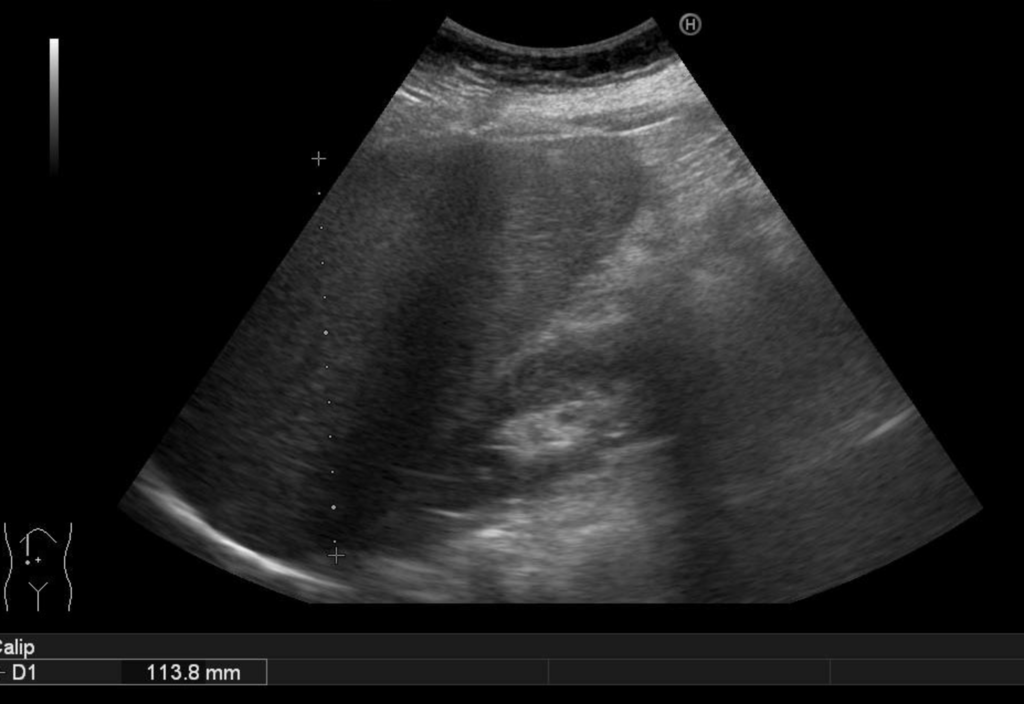 f:id:tsunepi:20171105184045p:plain f:id:tsunepi:20171105184045p:plain