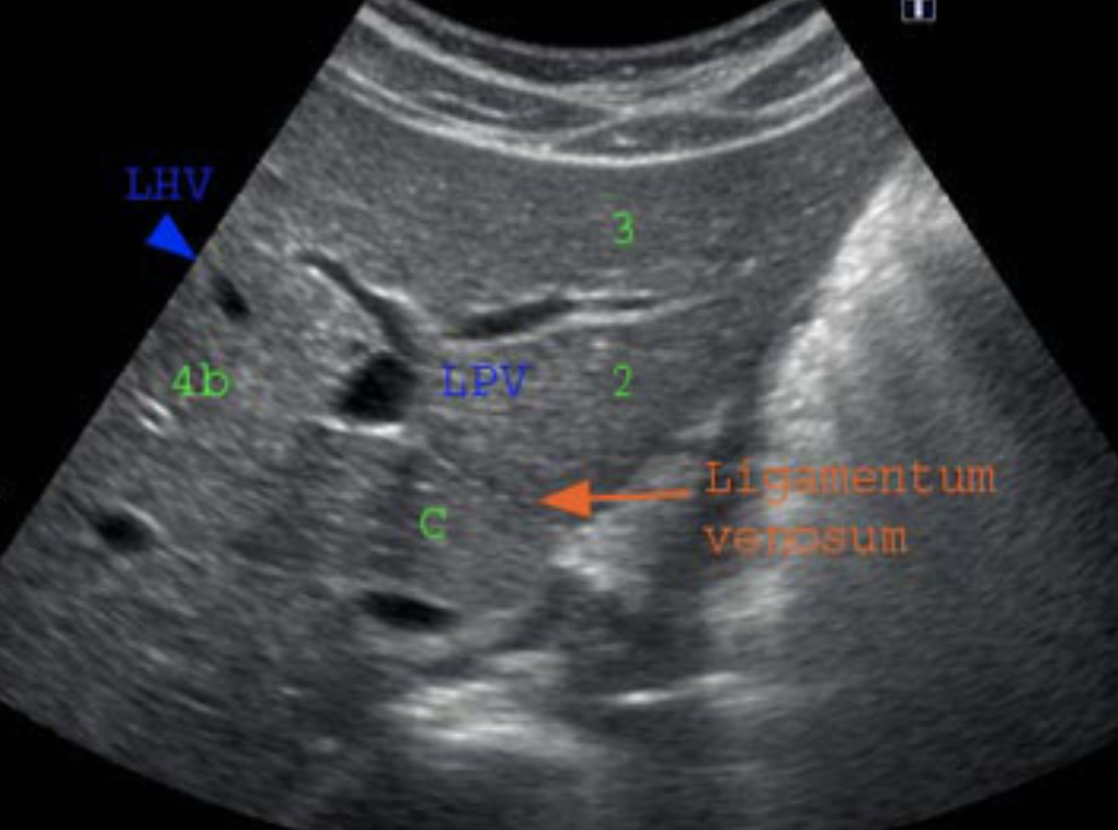 f:id:tsunepi:20171105184510p:plain f:id:tsunepi:20171105184510p:plain