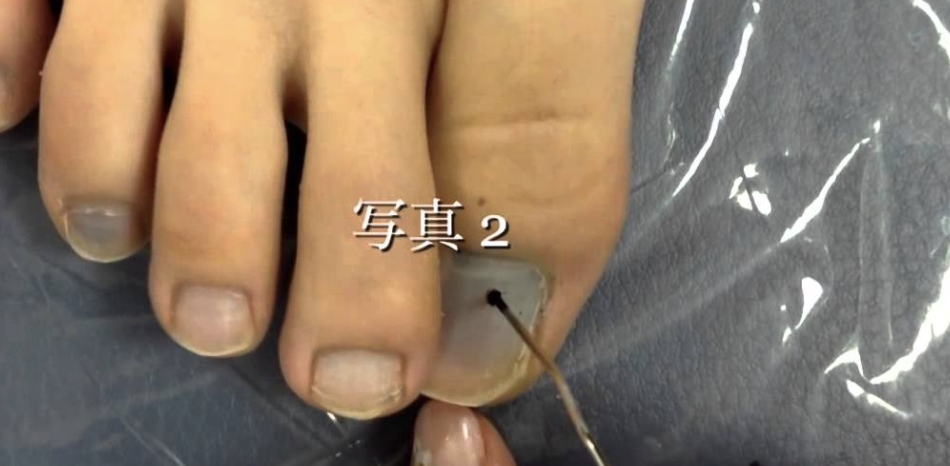 f:id:tsunepi:20180112161701p:plain