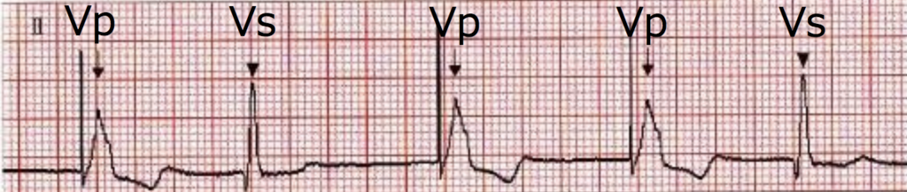 f:id:tsunepi:20181104085712p:plain f:id:tsunepi:20181104085712p:plain
