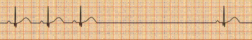 f:id:tsunepi:20181104085937p:plain f:id:tsunepi:20181104085937p:plain