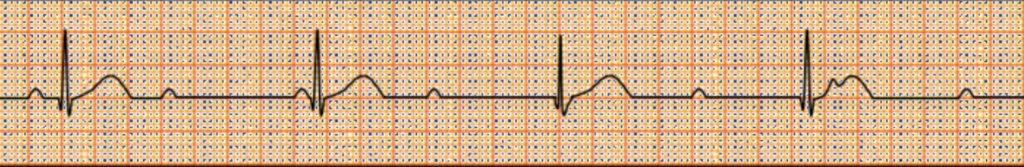 f:id:tsunepi:20181104092848p:plain f:id:tsunepi:20181104092848p:plain