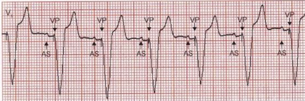 f:id:tsunepi:20181104093258p:plain f:id:tsunepi:20181104093258p:plain