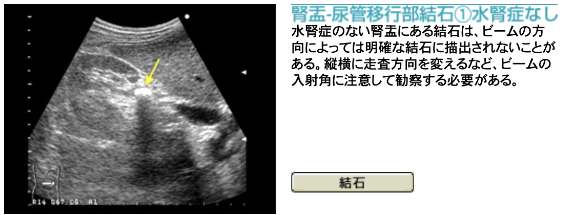 f:id:tsunepi:20201005160023p:plain f:id:tsunepi:20201005160023p:plain