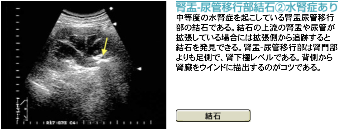 f:id:tsunepi:20201005160109p:plain f:id:tsunepi:20201005160109p:plain