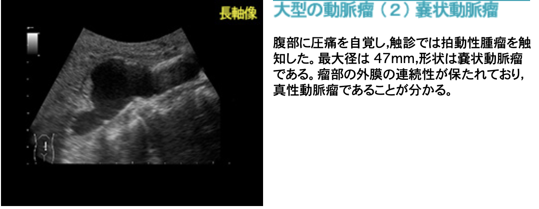 f:id:tsunepi:20201005162349p:plain