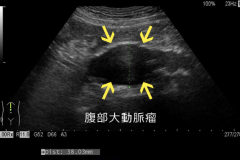 f:id:tsunepi:20201005162557p:plain