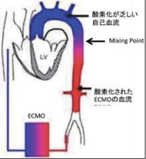 f:id:tsunepi:20210216095620p:plain