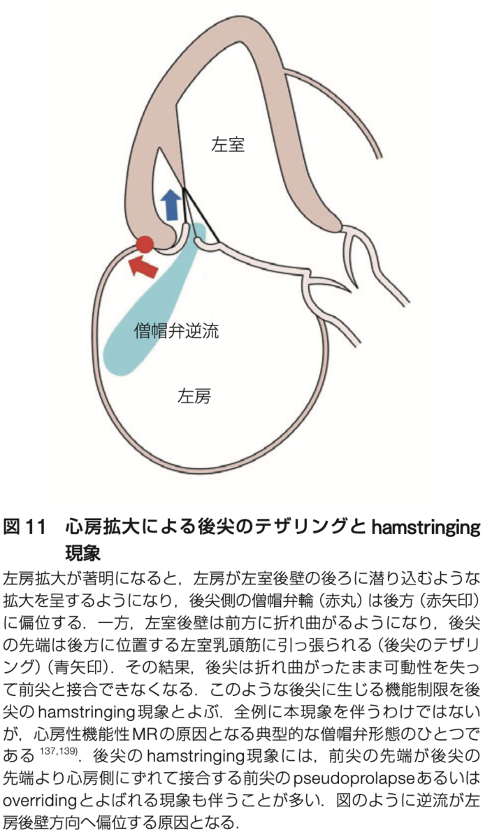 f:id:tsunepi:20210808191550p:plain