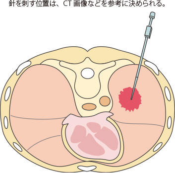 f:id:tsurezure4:20200918230318p:plain