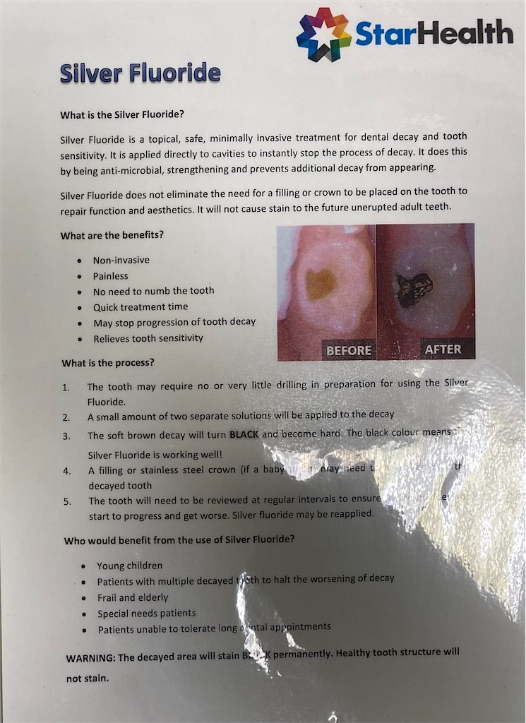 f:id:tsurezureaus:20210709081626j:image