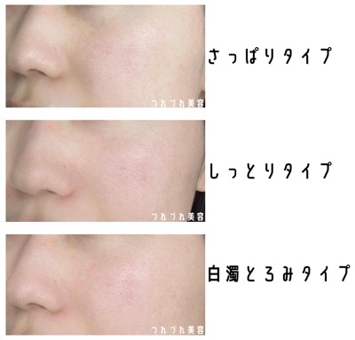 選び方】NOVのⅢシリーズ化粧水の違いは？全部比べてみた