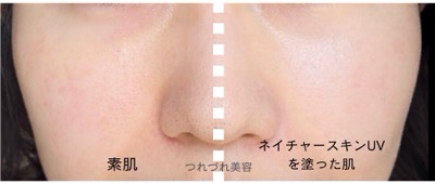 肌質改善？！プラージュボーテのスキンケアを使ってみた。口コミ