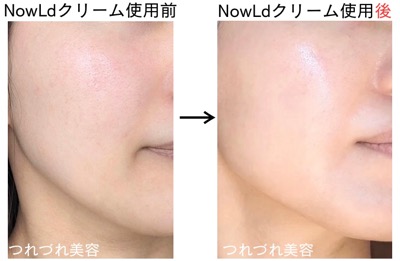 新品未開封　NowLd ノルド グロースクリーム（機能性クリーム）35g×5個 試してみた】グロースクリームグロープラスリフトフィト
