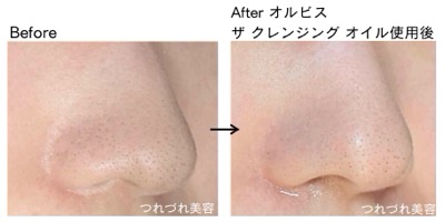 オルビス　ザクレンジングオイル　毛穴